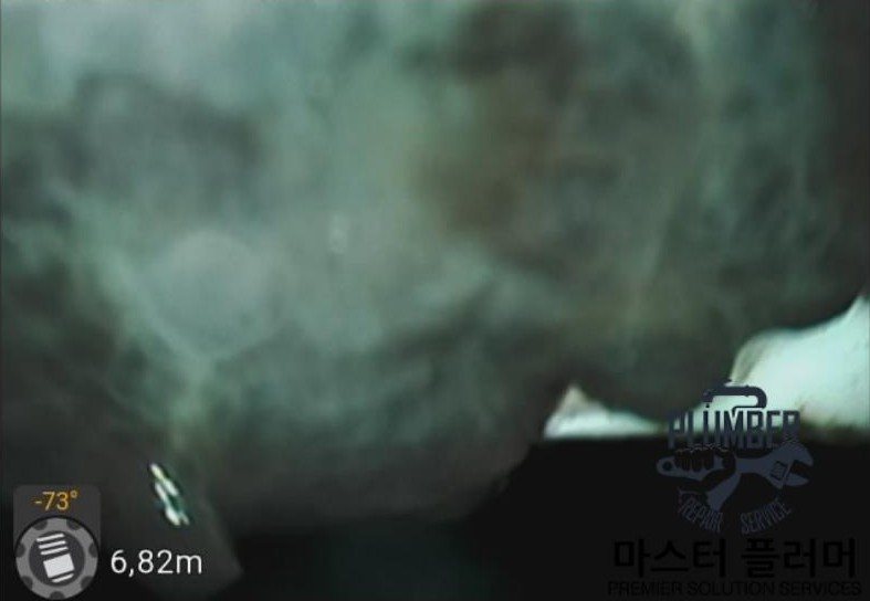 신정통기관 내시경 검사 — 입상관 벽면에 쌓인 슬러지